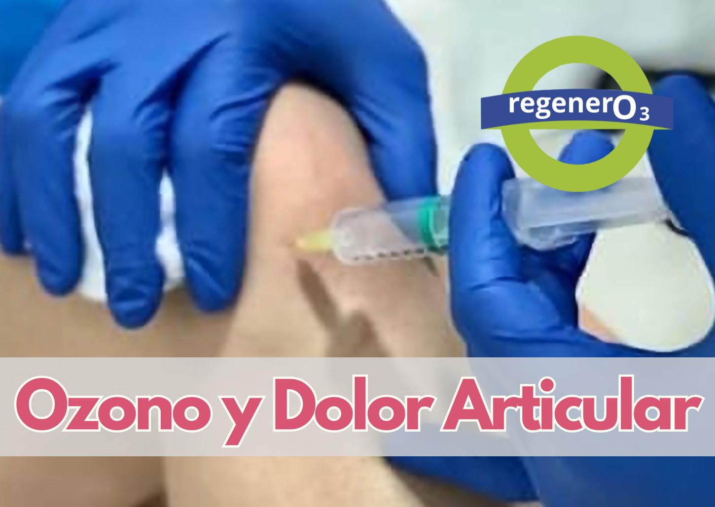 ¿Cómo puede ayudarte la ozonoterapia a cuidar tus articulaciones?