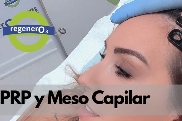 PRP y Mesoterapia en la caída del cabello