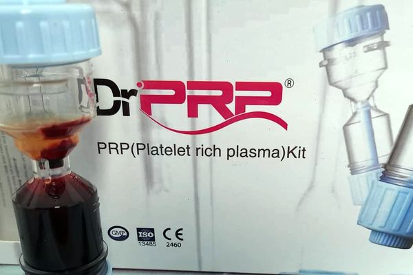 PRP Ozonizado para el tratamiento de lesiones de rodilla en atletas